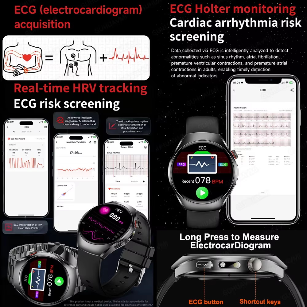 Nuovo marchio 2026 aggiornamen - Smartwatch Watches For Women Branded recensione e prezzo